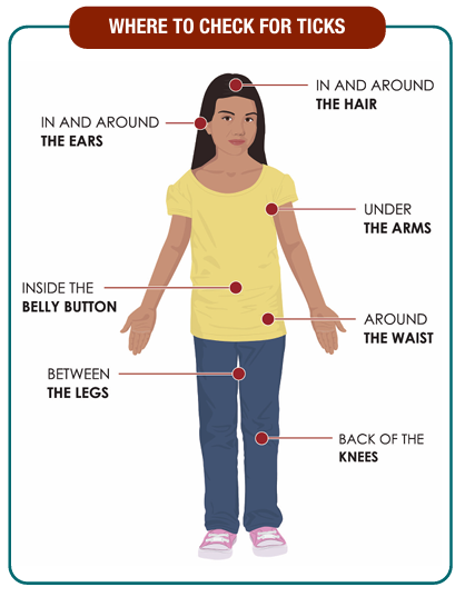 where to check for ticks.png